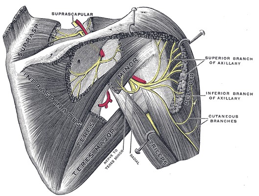 tenditis rotulinia